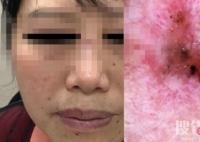 女子陪閨蜜就診自己卻被查出癌癥 檢查結(jié)果讓兩人同時大跌眼鏡