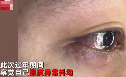 男子左眼皮異常抖動有蟲游走 照片揭露實(shí)在是太嚇人了