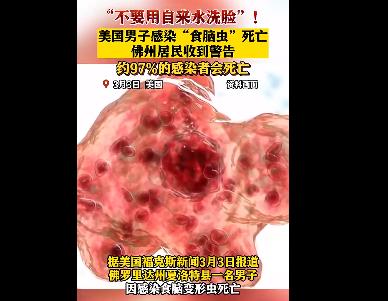 美國男子自來水洗臉感染食腦蟲死亡 背后真相曝光簡直太驚人了