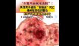 美國男子自來水洗臉感染食腦蟲死亡 原因揭秘直接讓人傻眼了