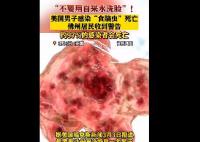美國男子自來水洗臉感染食腦蟲死亡 真相揭露真的令人大吃一驚