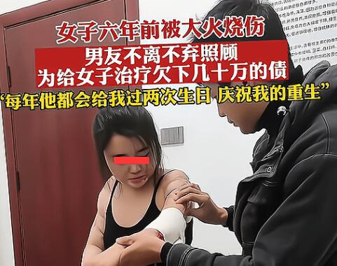 男子照顧大面積燒傷女友6年 到底是什么情況?