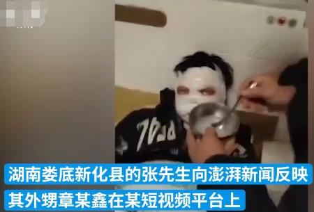12歲男孩看短視頻學做火藥被炸傷 背后原因簡直驚呆了眾人