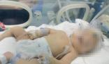 嬰兒出生后顱骨骨折 醫院回應 結果真的令人大吃一驚