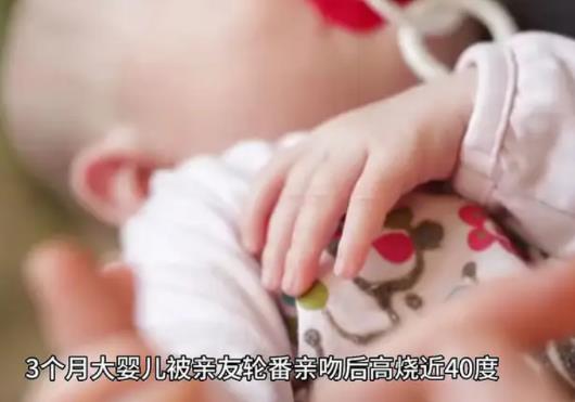 嬰兒被親友輪番親吻高燒近40度 真相曝光簡直太驚人了
