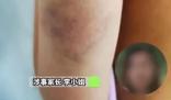 教師體罰學(xué)生被開除44名家長挽留 始料未及真相簡直太意外了