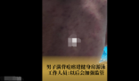 女子吐槽男子滿背疙瘩進泳池游泳 內幕曝光簡直太意外了