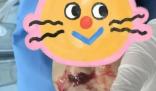 奶奶向3歲男童鼻腔塞頭發(fā)止血 背后原因簡直驚呆了眾人