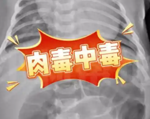 52天嬰兒喝奶奶喂的蜂蜜水中毒進(jìn)ICU 事件始末2025最新消息