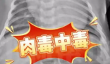 52天嬰兒喝奶奶喂的蜂蜜水中毒進(jìn)ICU 事件始末2025最新消息
