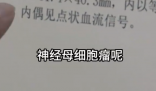 女孩因個矮去體檢發現腎上長腫瘤 事件始末2025最新消息