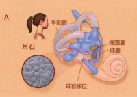 25歲女子長(zhǎng)期熬夜打麻將患耳石癥 內(nèi)幕實(shí)在讓人驚個(gè)呆
